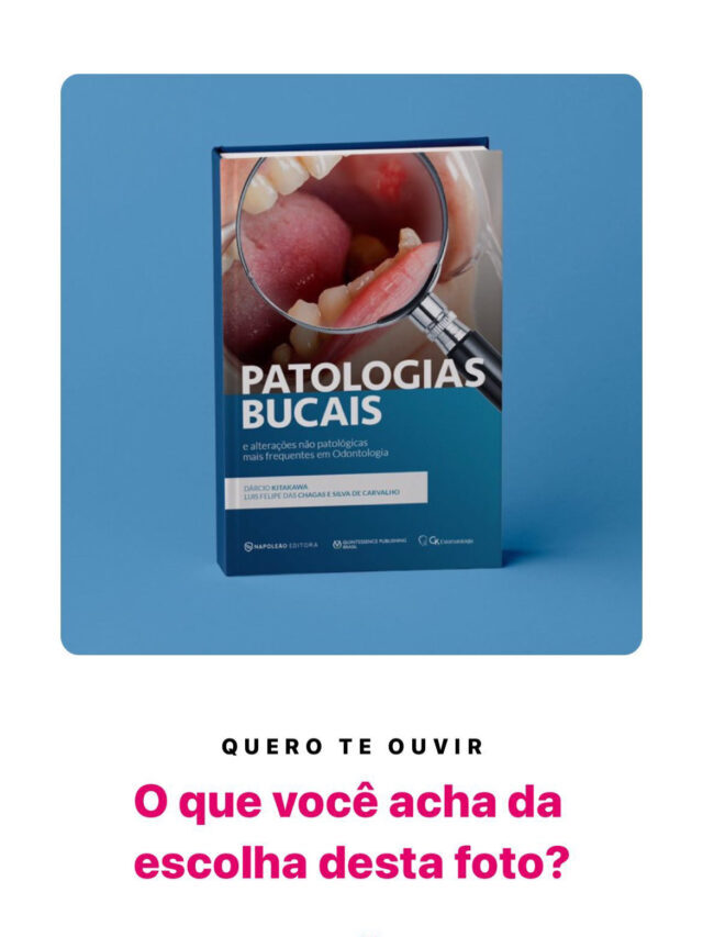 Problema na foto